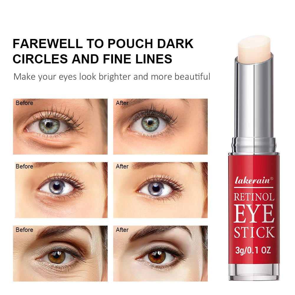"Crema de ojos antiarrugas con retinol"
