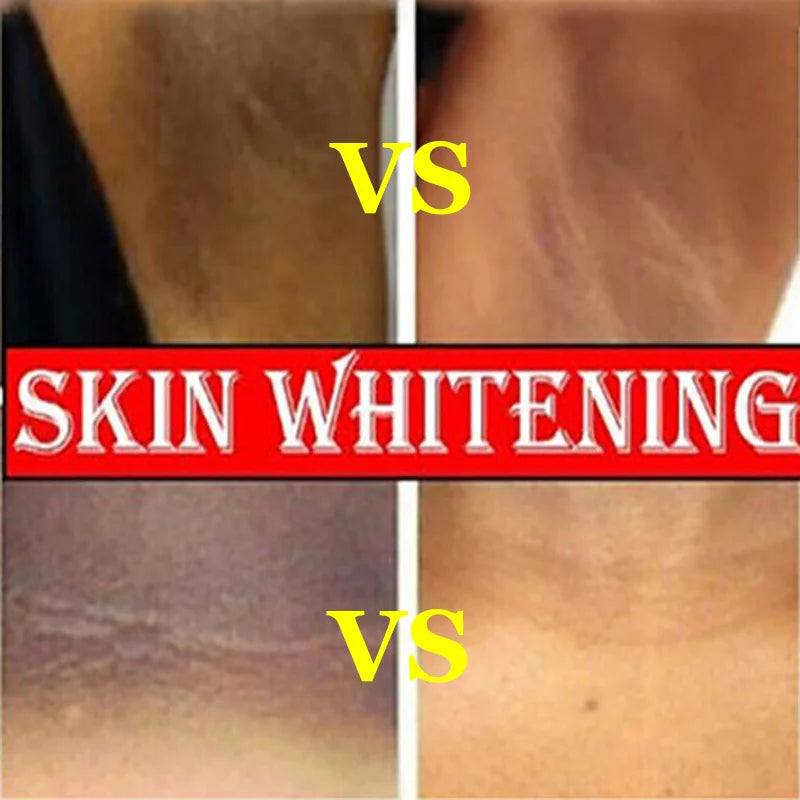 Crema Blanqueadora para Zonas Íntimas, Axilas y Rodillas | Aclarante e Hidratante